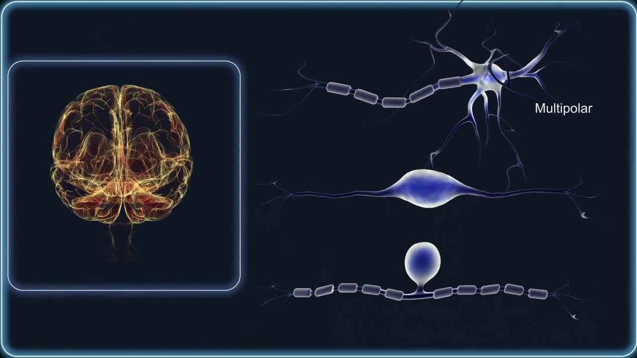 Alzheimer e Parkinson, nuovi metodi diagnostici