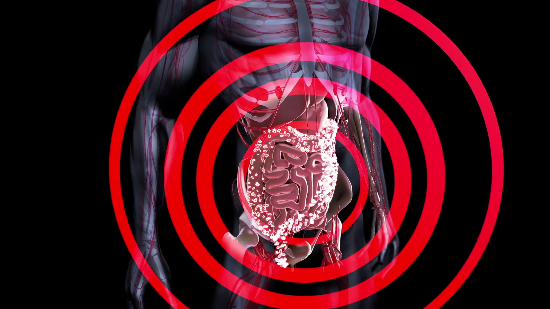 Malattie croniche dell’intestino per 250 mila italiani