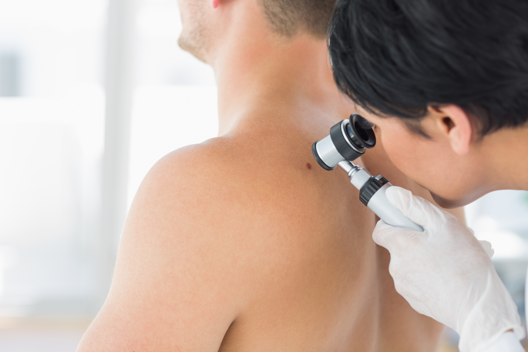 Salute. Passi avanti nella cura del melanoma, presto il vaccino