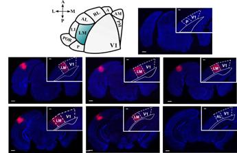 Le aree visive superiori del cervello influiscono sulla percezione della realtà